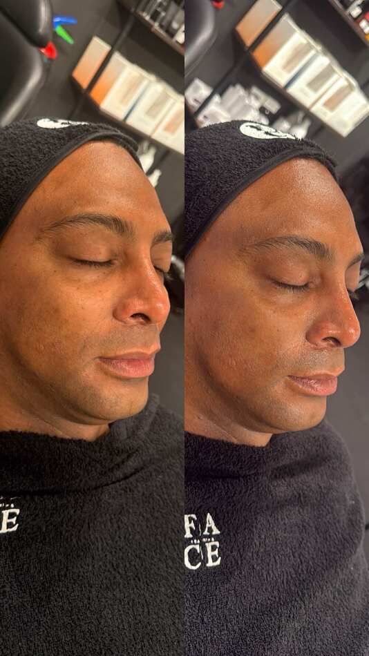 Resultado real de clienta de Face Training Donostia: antes y después